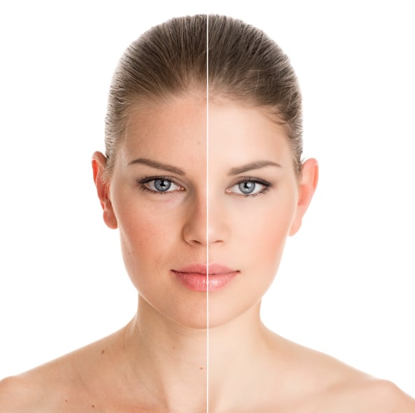 skin treatment in delhi at low cost vivaesthetique Facial Rejuvenation